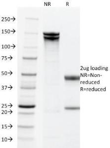 SDS-PAGE analysis of Anti-EpCAM Antibody [PAN-EpCAM] under non-reduced and reduced conditions; showing intact IgG and intact heavy and light chains, respectively. SDS-PAGE analysis confirms the integrity and purity of the antibody