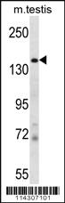 Anti-JHDM2a Rabbit Polyclonal Antibody