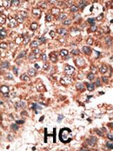 Anti-MMP20 Rabbit Polyclonal Antibody