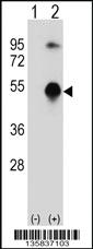 Anti-GATA3 Rabbit Polyclonal Antibody