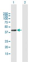 Anti-SETMAR Mouse Polyclonal Antibody