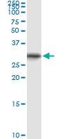 Anti-ORC6L Polyclonal Antibody Pair