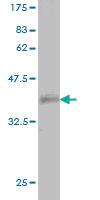 Anti-ABCC1 Mouse Monoclonal Antibody [clone: 1G8]