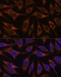 Immunofluorescence analysis of L929 cells using Anti-AGR2 Antibody (A10053) at a dilution of 1:100. DAPI was used to stain the cell nuclei (blue)