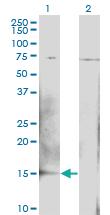 Anti-BTG2 Mouse Monoclonal Antibody [clone: 1B8]