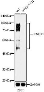 Western blot analysis of extracts from wild type(WT) and IFNGR1 knockout (KO) 293T(KO) cells, using Anti-IFNGR1 Antibody [ARC50421] (A80697) at 1:1,000 dilution. The secondary antibody was Goat Anti-Rabbit IgG H&L Antibody (HRP) at 1:10,000 dilution.