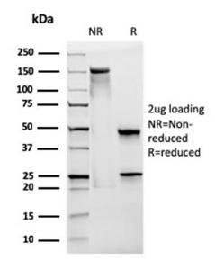 SDS-PAGE analysis of Anti-CD28 Antibody [CB28] under non-reduced and reduced conditions; showing intact IgG and intact heavy and light chains, respectively SDS-PAGE analysis confirms the integrity and purity of the antibody