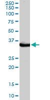 Anti-STUB1 Goat Polyclonal Antibody