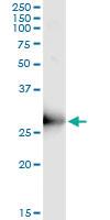 Anti-ORC6L Antibody Pair