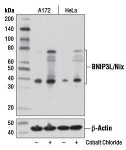 Anti-BNIP3L/Nix Rabbit Monoclonal Antibody [clone: 13G20]