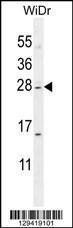 Anti-IQCF1 Rabbit Polyclonal Antibody (HRP (Horseradish Peroxidase))