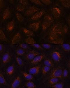 Immunofluorescence analysis of U-2 OS cells using Anti-AGR2 Antibody (A10053) at a dilution of 1:100. DAPI was used to stain the cell nuclei (blue)