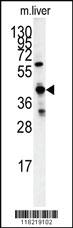 Anti-GCAT Rabbit Polyclonal Antibody