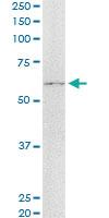 Anti-ASPSCR1 Mouse Monoclonal Antibody [clone: 3D10-1D11]