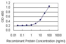 Anti-TRIM62 Mouse Monoclonal Antibody [clone: 4A4]