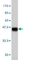 Anti-ERN1 Mouse Monoclonal Antibody [clone: 6G11]