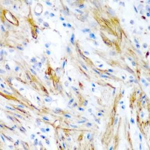 Antibody anti-LMOD1 100 µl