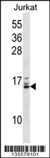 Anti-HIST1H2BB/HIST1H2BE Rabbit Polyclonal Antibody