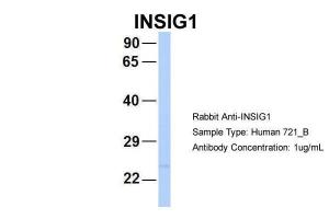 Anti-INSIG1 Rabbit Polyclonal Antibody