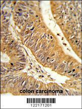 Anti-CXXC4 Rabbit Polyclonal Antibody