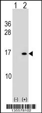 Anti-HIST1H2BB/HIST1H2BE Rabbit Polyclonal Antibody