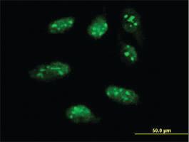 Anti-LHX1 Mouse Monoclonal Antibody [clone: 4D1]