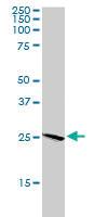 Anti-BAK Goat Polyclonal Antibody