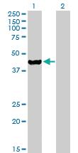 Anti-ETNK2 Mouse Polyclonal Antibody