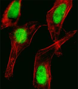 Anti-HOXC10 Rabbit Polyclonal Antibody (APC (Allophycocyanin))