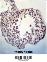 Anti-TPTEa Rabbit Polyclonal Antibody (HRP (Horseradish Peroxidase))