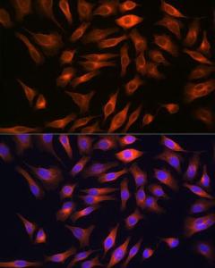 Immunofluorescence analysis of HeLa cells using Anti-FBP1 Antibody [ARC0664] (A80698) at a dilution of 1:100 (40x lens) DAPI was used to stain the cell nuclei (blue)