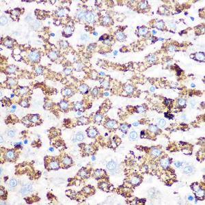 Immunohistochemistry analysis of paraffin-embedded rat liver using Anti-GLUD1 Antibody [ARC1216] (A305787) at a dilution of 1:100 (40X lens). Perform microwave antigen retrieval with 10 mM Tris/EDTA buffer pH 9.0 before commencing with IHC staining protocol