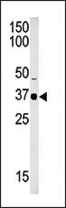 Anti-SETD7 Rabbit Polyclonal Antibody