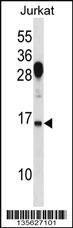 Anti-RHOG Rabbit Polyclonal Antibody