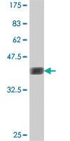 Anti-CIAPIN1 Mouse Polyclonal Antibody