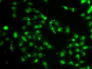 Antibody anti-L3MBTL1 100 µl