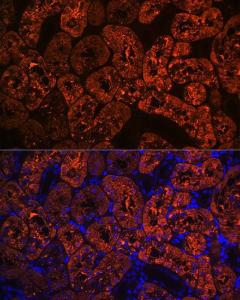 Immunofluorescence analysis of rat kidney using Anti-FBP1 Antibody [ARC0664] (A80698) at a dilution of 1:100 (40x lens) DAPI was used to stain the cell nuclei (blue)