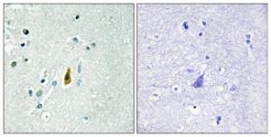 Anti-p53 Rabbit Polyclonal Antibody