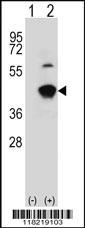 Anti-GCAT Rabbit Polyclonal Antibody