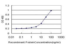 Anti-LHX1 Mouse Monoclonal Antibody [clone: 4D1]