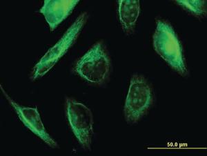 Anti-TUBA1A Mouse Monoclonal Antibody [clone: 2D2]