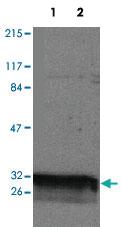 Anti-YWHAQ Rabbit Polyclonal Antibody