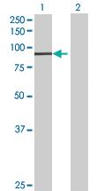 Anti-PANK4 Mouse Polyclonal Antibody