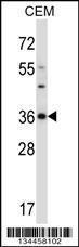 Anti-CDK3 Rabbit Polyclonal Antibody (AP (Alkaline Phosphatase))