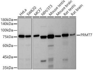 Anti-PRMT7 Rabbit Monoclonal Antibody [clone: ARC2967]