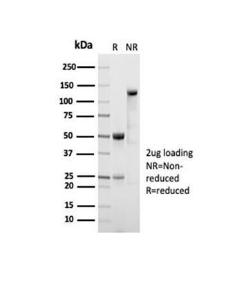 Anti-ALDH1A1 Rabbit Recombinant Antibody [clone: ALDH1A1/7011R]