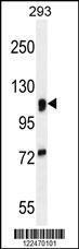 Anti-MAN2A1 Rabbit Polyclonal Antibody