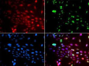 Antibody anti-L3MBTL1 100 µl