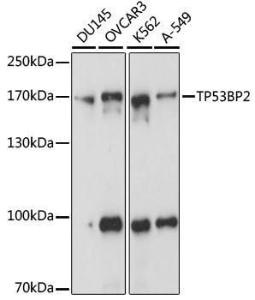 Anti-53BP2/ASPP2/BBP antibody