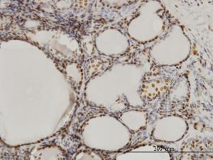 Anti-SFPQ Mouse Monoclonal Antibody [clone: 6D7]